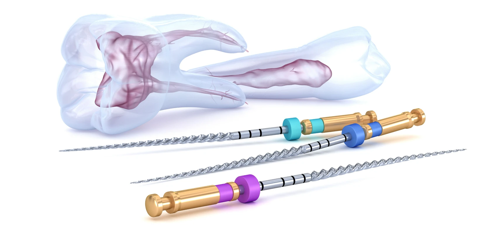 Traitement endodontique / dévitalisation